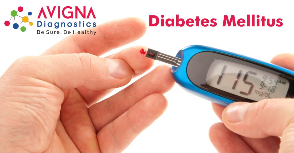 Diagnosis of Diabetes Mellitus