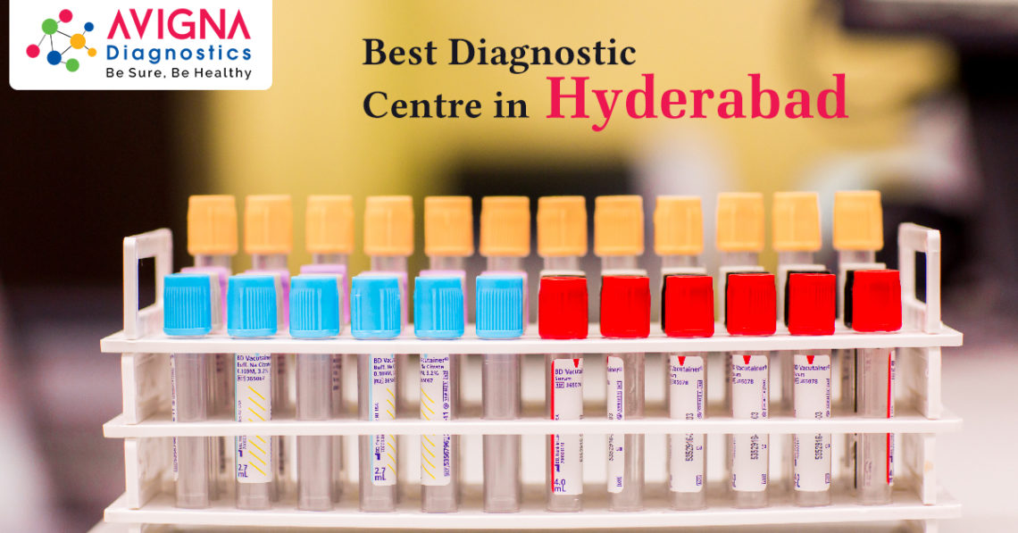 Best Diagnostic Centres in Hyderabad