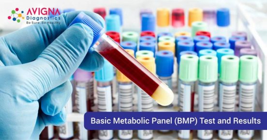 Basic Metabolic Panel (BMP) Test and Results