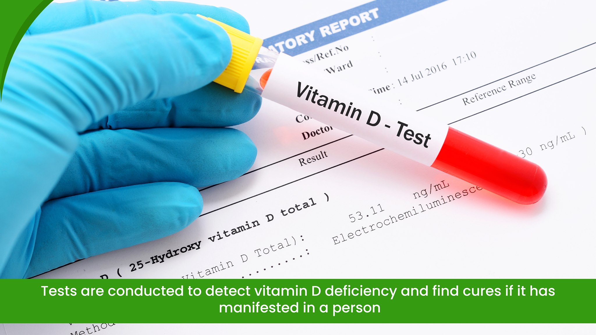Detect Vitamin D Deficiency
