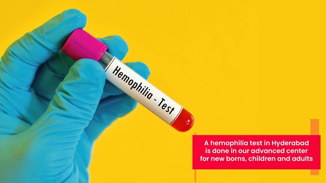 A hemophilia test in Hyderabad