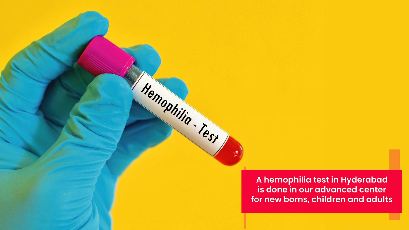 http://avignadiagnostics.com/creating-clarity/hemophilia-awareness/A hemophilia test in Hyderabad