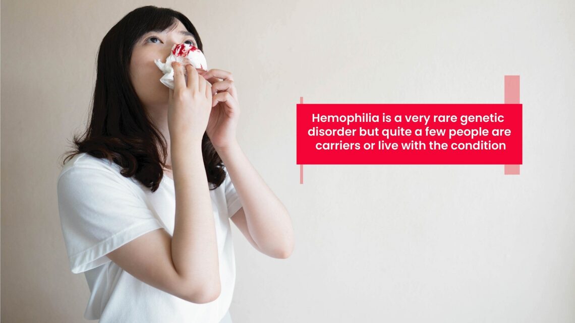 Hemophilia is a very rare genetic disorder