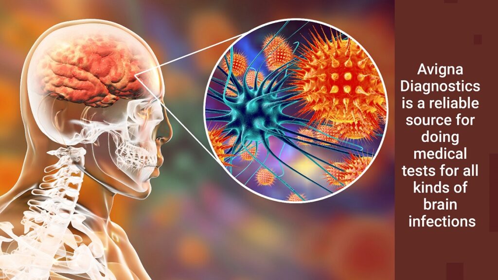 bacteria-living-in-the-brain-how-do-we-detect-the-harm