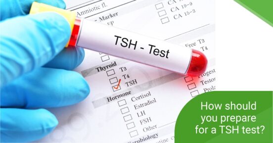Prepare for a TSH test