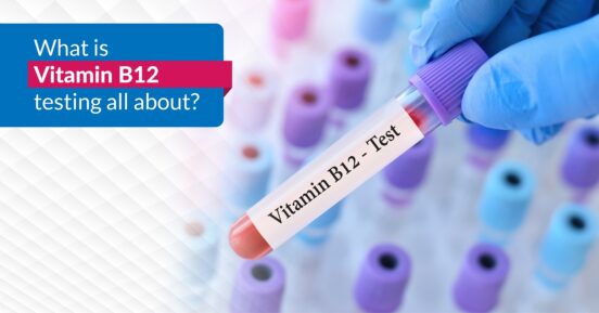 What is Vitamin B12 testing all about?