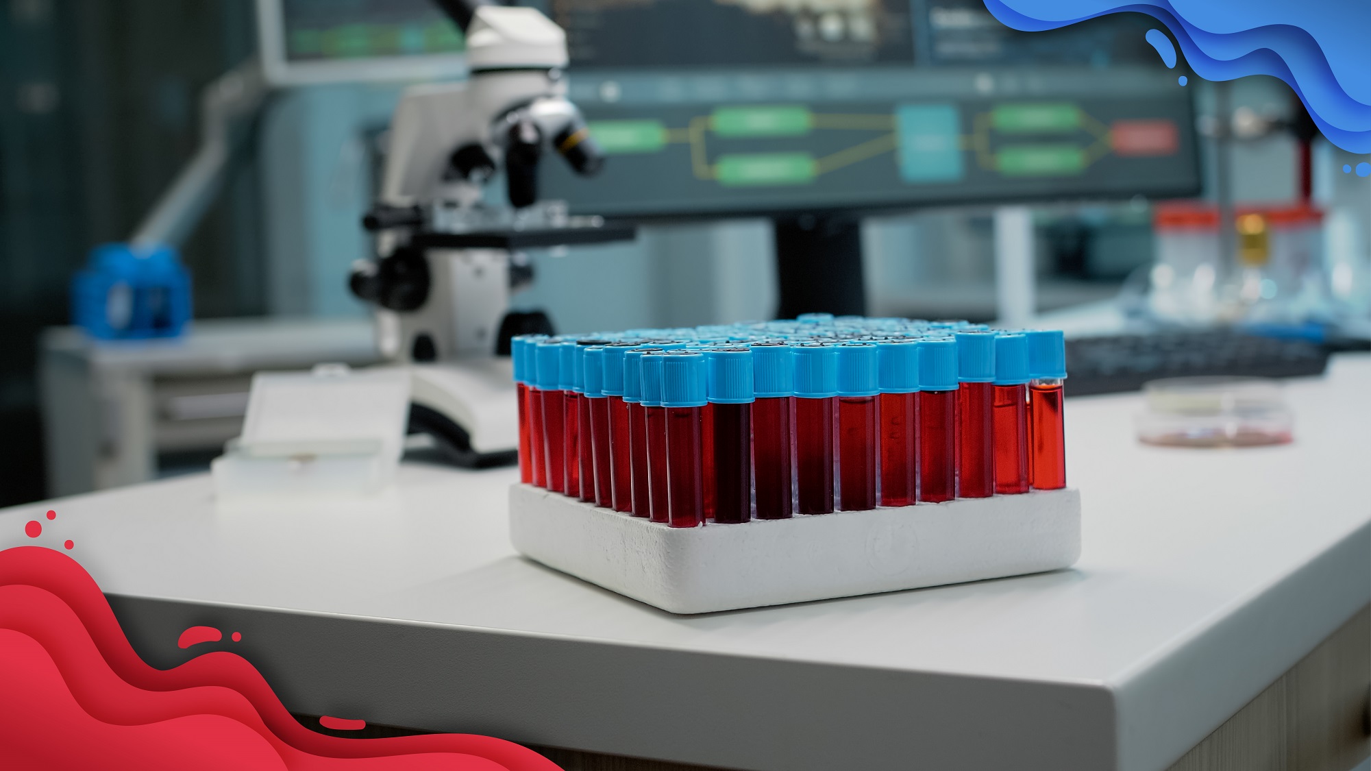 Knowing the purpose of blood culture test in a lab