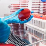 What is a blood culture test? Why is it important for some patients?