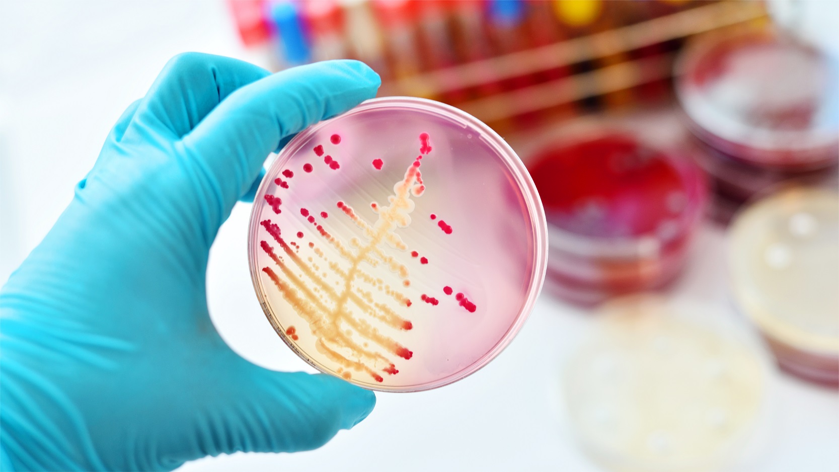 Come to Avigna Diagnostics for blood culture test in Hyderabad