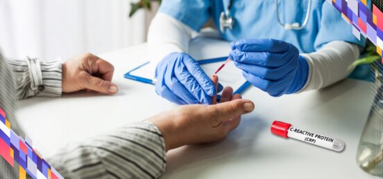 CRP blood test for inflammation