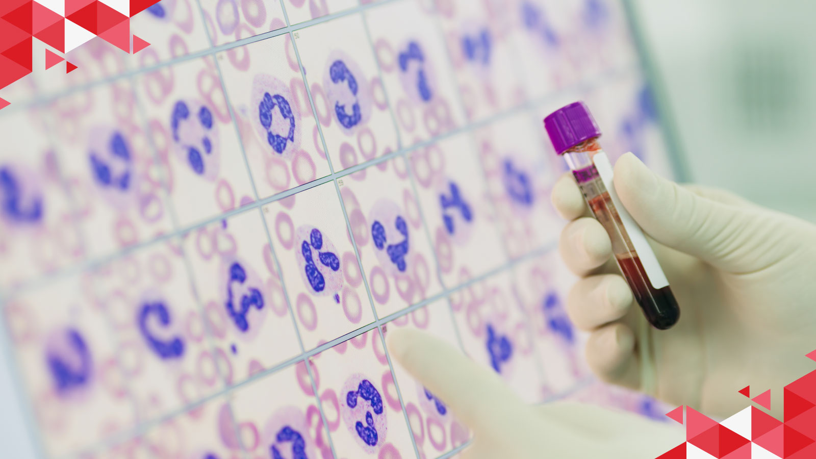 Digital malaria testing tools are transforming diagnosis Digital malaria testing tools are transforming diagnosis — from advanced clinical laboratories to remote healthcare settings.