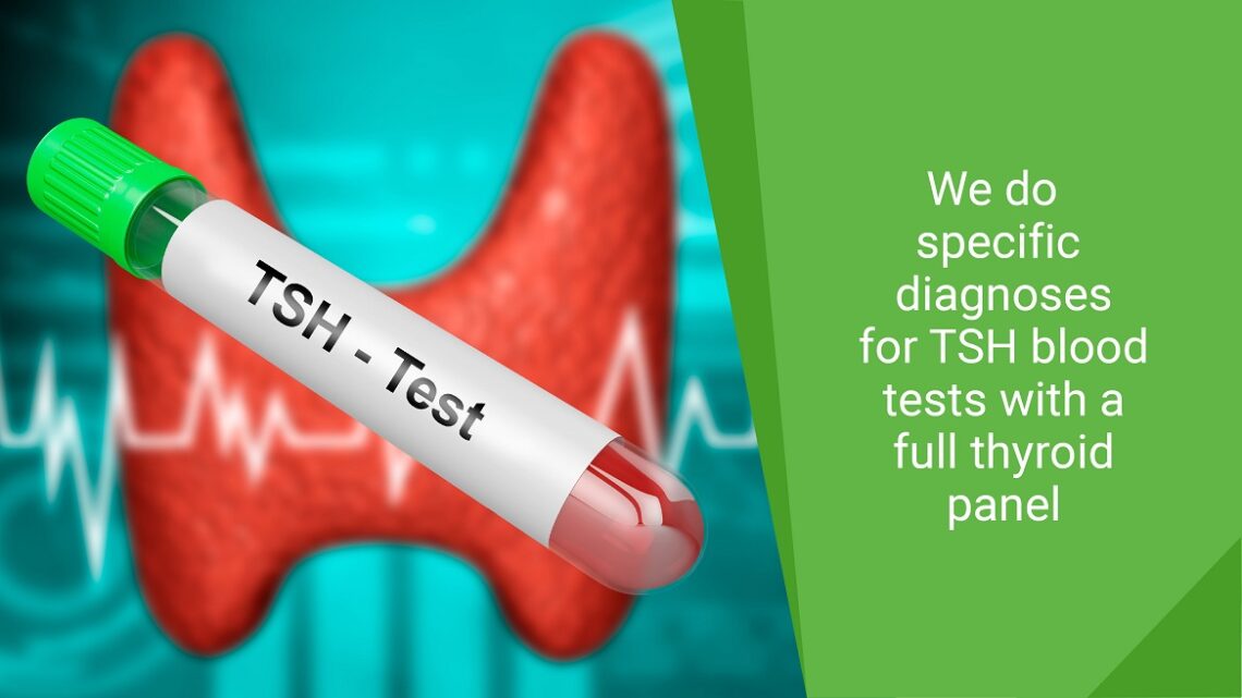 how-should-you-prepare-for-a-tsh-test-tests-for-thyroid